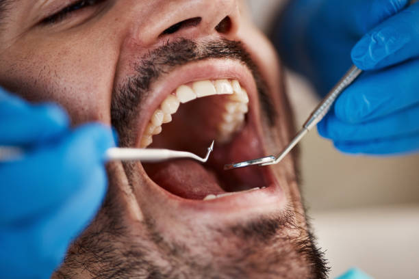 Best Emergency Dental Filling Replacement  in Central City, PA